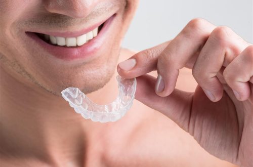 Invisalign: Rethinking Orthodontics with Advanced Material Sciences